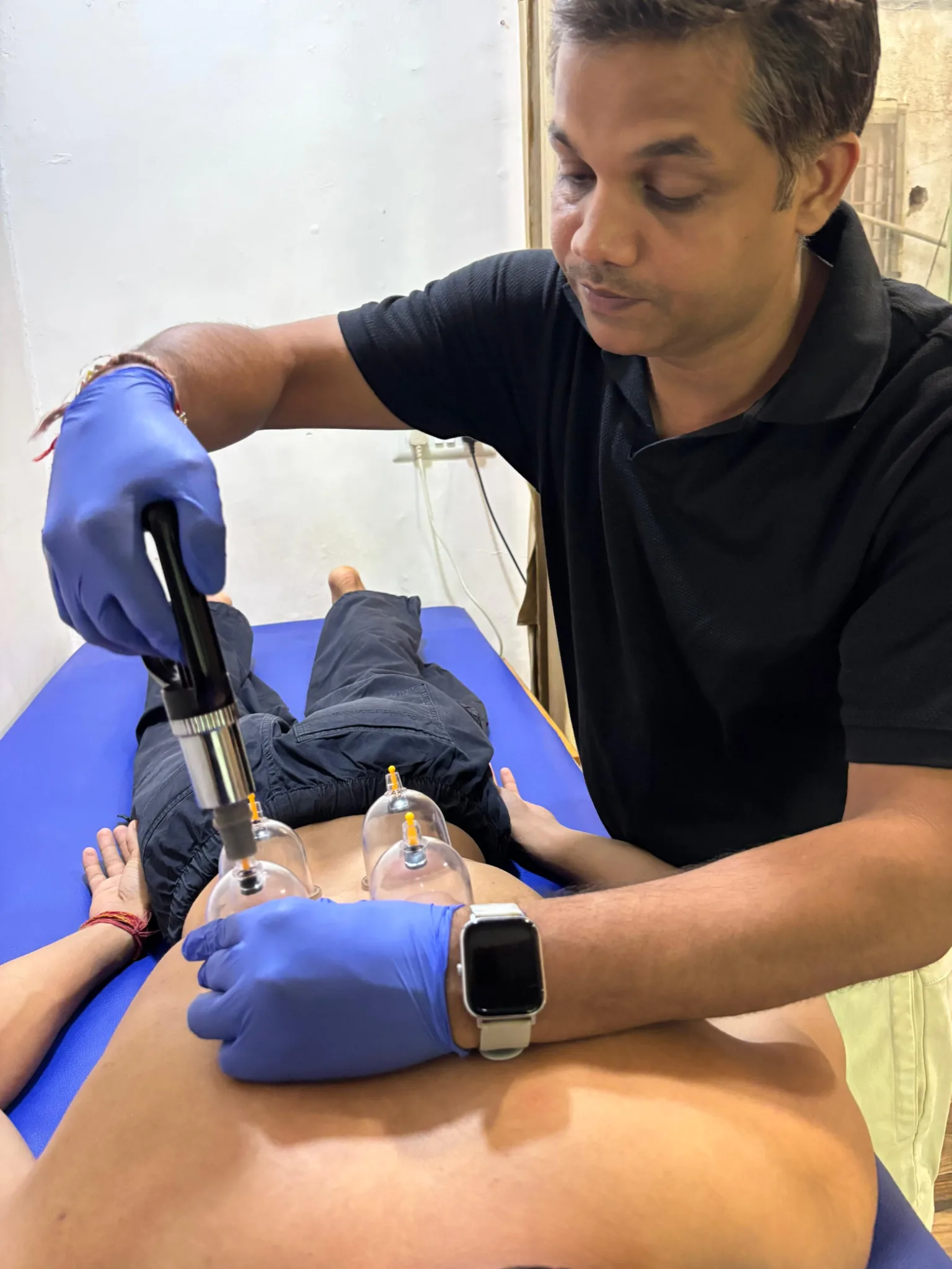 Cupping Therapy